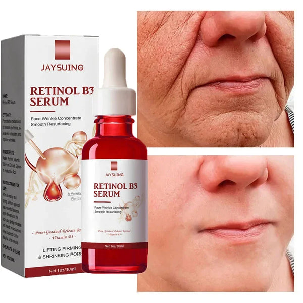 Retinol Wrinkle Remover Face Serum